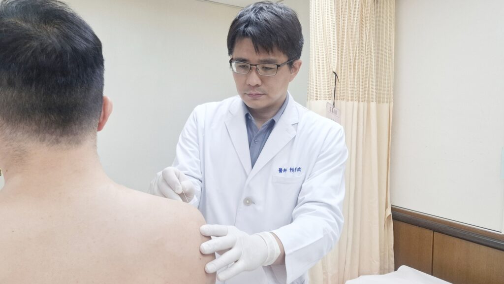 肩痛如「被封印」 中醫「小針刀」助重拾靈活 15 賴博政醫師為病人施以「微創小針刀」治療,鬆解局部沾黏,肩膀恢復正常活動。