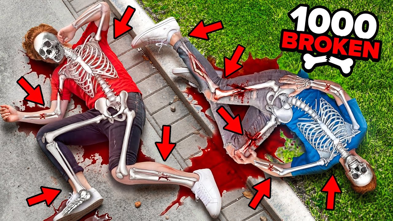 We Broke ALL 1,000 BONES in GTA 5 RP.. We Broke ALL 1,000 BONES in GTA 5 RP..