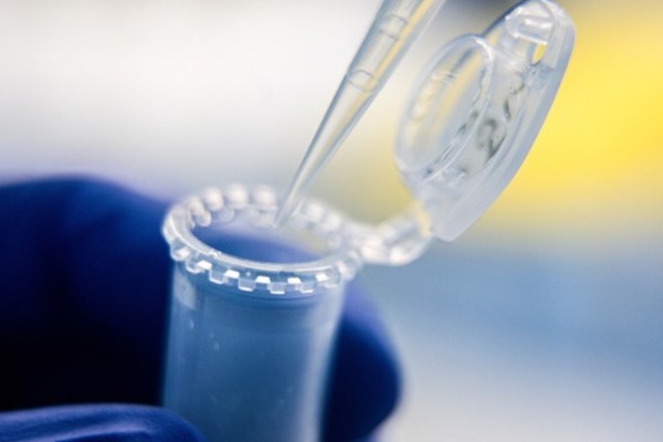 Gli scienziati avvertono i tagli di finanziamento di $ 4 miliardi di Trump danneggeranno la ricerca medica degli Stati Uniti Gli scienziati avvertono i tagli di finanziamento di $ 4 miliardi di Trump danneggeranno la ricerca medica degli Stati Uniti