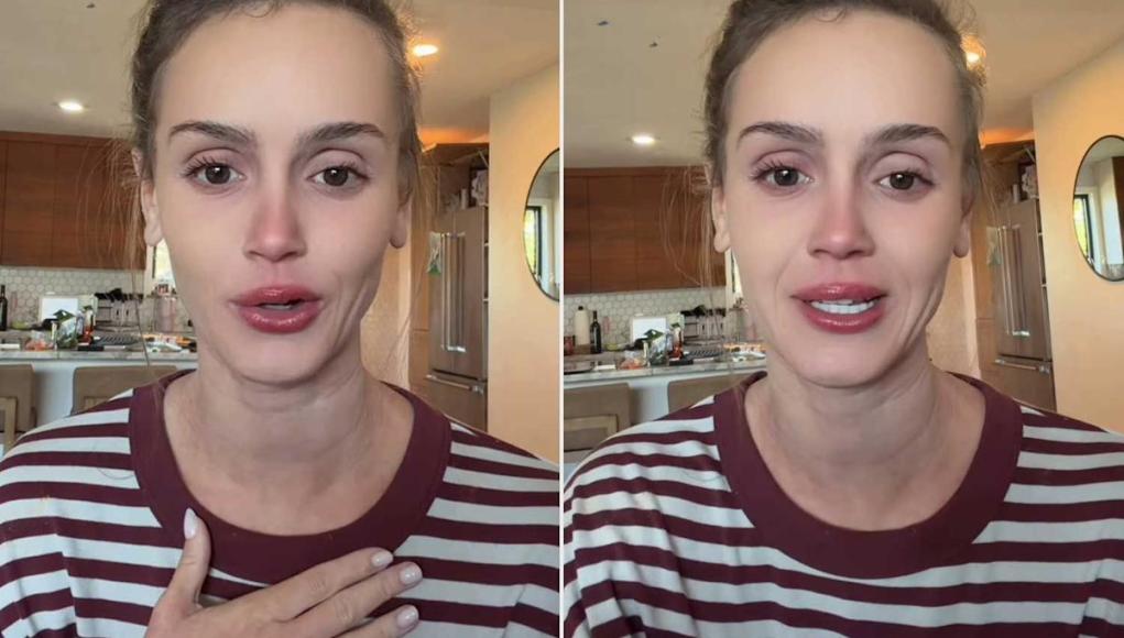 La estrella de “Mormon Wives”, Mikayla Matthews, rompe a llorar por los brotes ‘traumáticos’ de la piel La estrella de “Mormon Wives”, Mikayla Matthews, rompe a llorar por los brotes ‘traumáticos’ de la piel