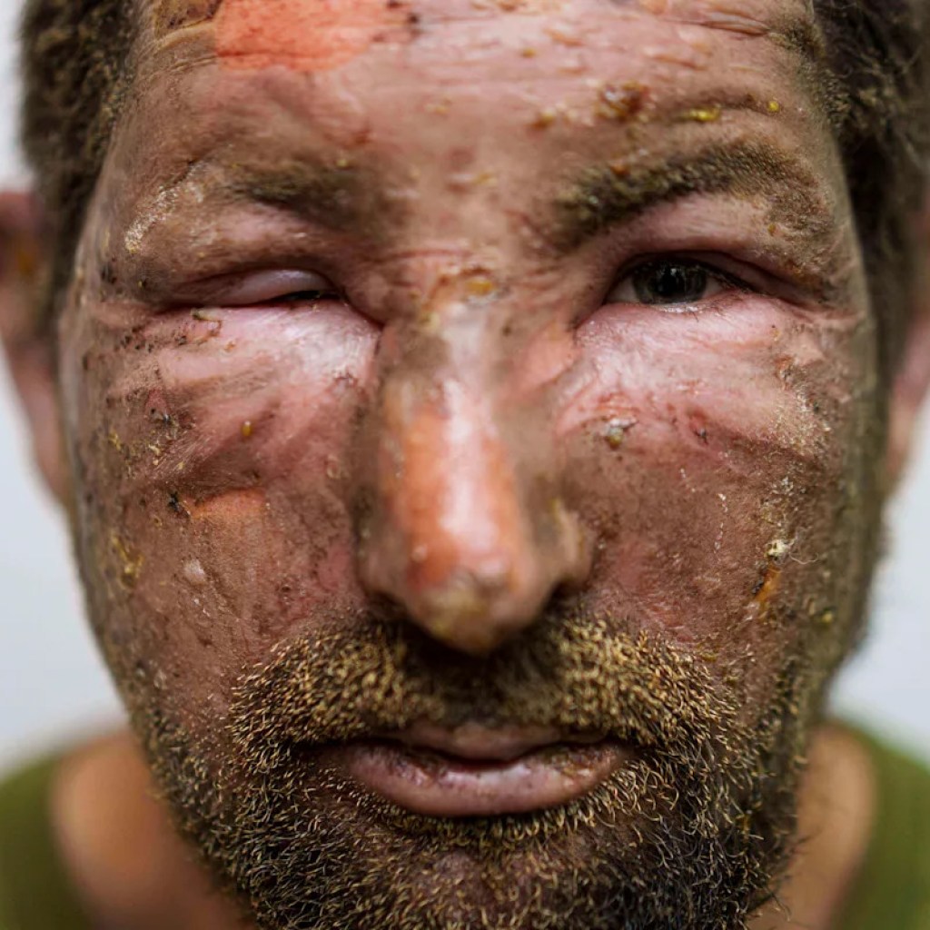 Excessive-tech drones flip Ukraine’s entrance line right into a lethal kill zone, complicating evacuations Excessive-tech drones flip Ukraine’s entrance line right into a lethal kill zone, complicating evacuations