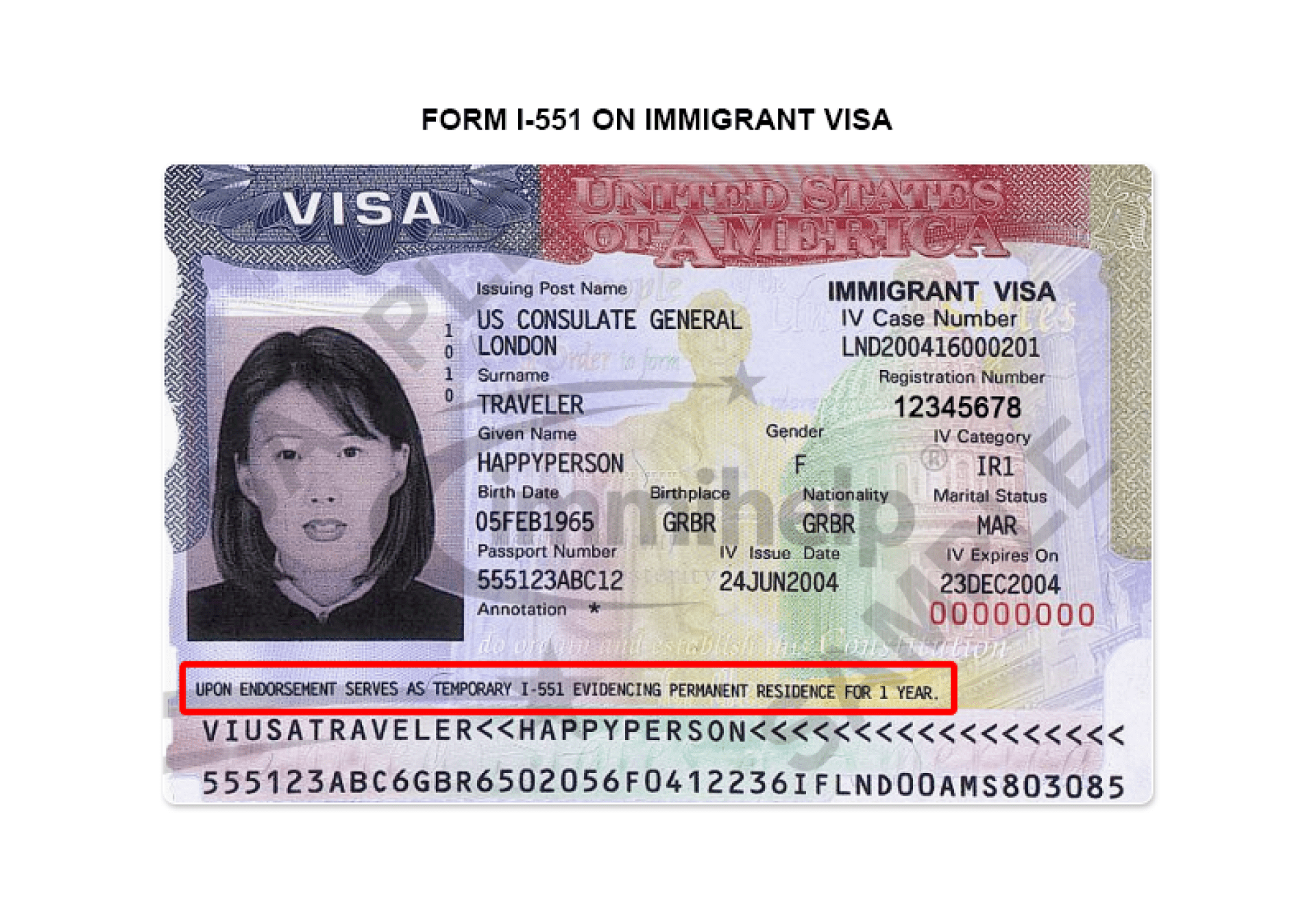 Can I Travel With I-551 Stamp? Can I Travel With I-551 Stamp?