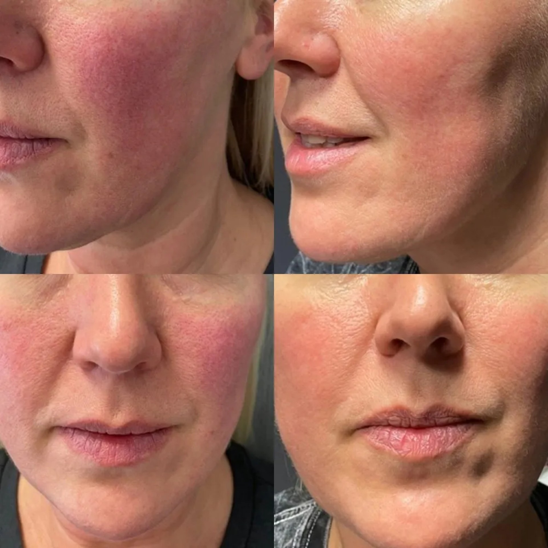 What is Face Stamping A Comprehensive Guide What is Face Stamping A Comprehensive Guide