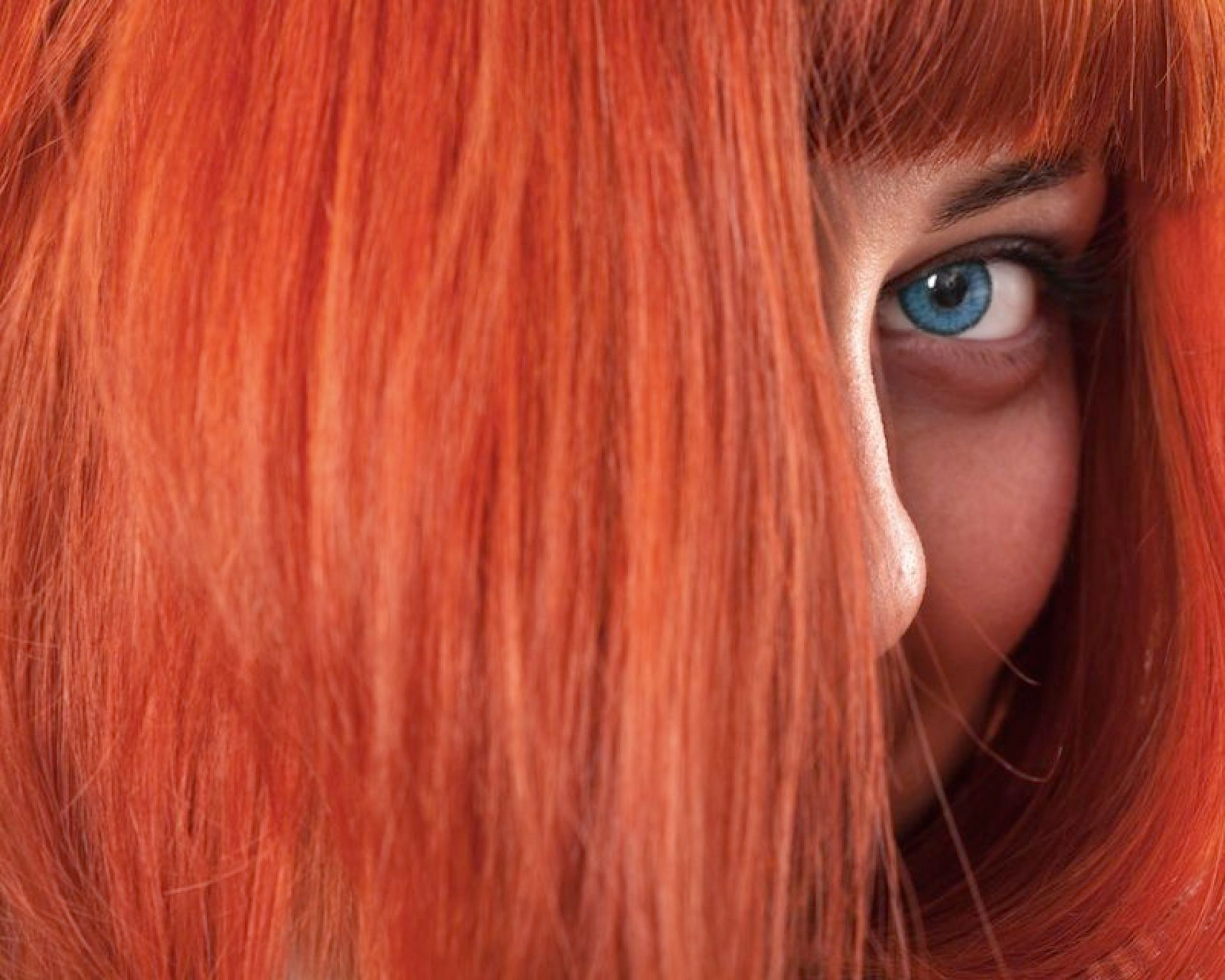 Red Hair and Yellow Stroma Is It Common? Red Hair and Yellow Stroma Is It Common?