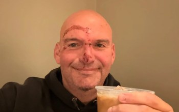 Senator John Fetterman Shares Photo After Fall, 20 Stitches and Cardiac Scare Senator John Fetterman Shares Photo After Fall, 20 Stitches and Cardiac Scare