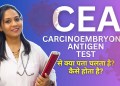 Carcinoembryonic Antigen Test Kya Hota Hai? CEA Test Explained by Doctor Varun Carcinoembryonic Antigen Test Kya Hota Hai? CEA Test Explained by Doctor Varun