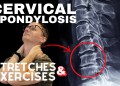 Cervical Spondylosis (Neck Arthritis) Stretches & Exercises | Dr. Jon Saunders Cervical Spondylosis (Neck Arthritis) Stretches & Exercises | Dr. Jon Saunders