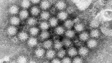Nasty norovirus is back in full force with US cases of the stomach virus surging Nasty norovirus is back in full force with US cases of the stomach virus surging