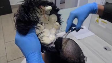 Watch video of hairy situation Watch video of hairy situation