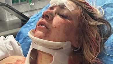 Bride-to-Be Knocked Unconscious in ‘Horrifying, Shocking Attack’ During Her Bachelorette Party Bride-to-Be Knocked Unconscious in ‘Horrifying, Shocking Attack’ During Her Bachelorette Party