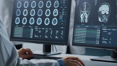 ‘Use it or lose it’ ‘Use it or lose it’