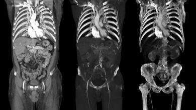 ‘Exposures are … projected to increase’ ‘Exposures are … projected to increase’