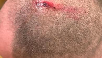 ‘Everything just kind of went sideways:’ Passenger recounts plane crash landing at Toronto airport ‘Everything just kind of went sideways:’ Passenger recounts plane crash landing at Toronto airport