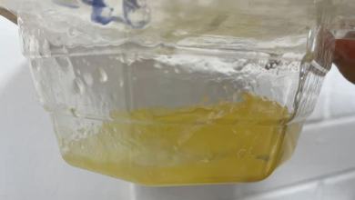 Woman, 32, Credits Her ‘Quite Big’ Breast Implants with Helping Her Discover a Cancerous Lump by ‘Pushing It Forward’ Woman, 32, Credits Her ‘Quite Big’ Breast Implants with Helping Her Discover a Cancerous Lump by ‘Pushing It Forward’