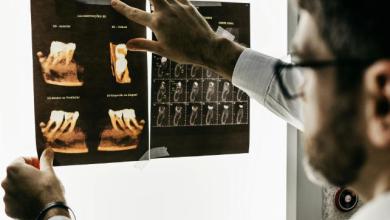 The Cause of Alzheimer’s Might Be Coming From Inside Your Mouth The Cause of Alzheimer’s Might Be Coming From Inside Your Mouth