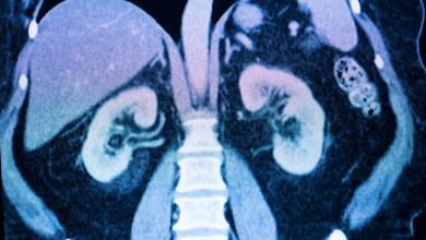 Scientists make alarming discovery about health impact of drinking bottled water — here’s what you need to know Scientists make alarming discovery about health impact of drinking bottled water — here’s what you need to know