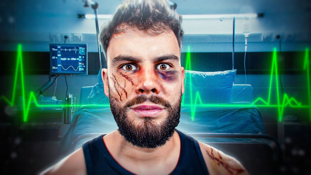 JE ME SUIS FAIS CASSER LA BOUCHE EN 4K 60 FPS JE ME SUIS FAIS CASSER LA BOUCHE EN 4K 60 FPS
