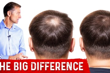 Normal Hair Loss vs. Abnormal Hair Loss Normal Hair Loss vs. Abnormal Hair Loss