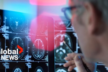 Canada approves new drug that can slow Alzheimer’s disease Canada approves new drug that can slow Alzheimer’s disease