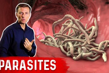 The Best Herbs for Parasites The Best Herbs for Parasites