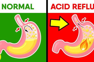 How Baking Soda can help with Acid Reflux & Heartburn How Baking Soda can help with Acid Reflux & Heartburn