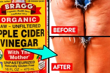 19 Foods that blast away your Body Cellulite 19 Foods that blast away your Body Cellulite
