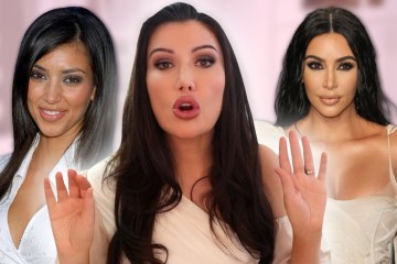 Kim Kardashian : Plastic surgery (2000-2020) Kim Kardashian : Plastic surgery (2000-2020)