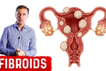 The Best Foods to Shrink Fibroids The Best Foods to Shrink Fibroids