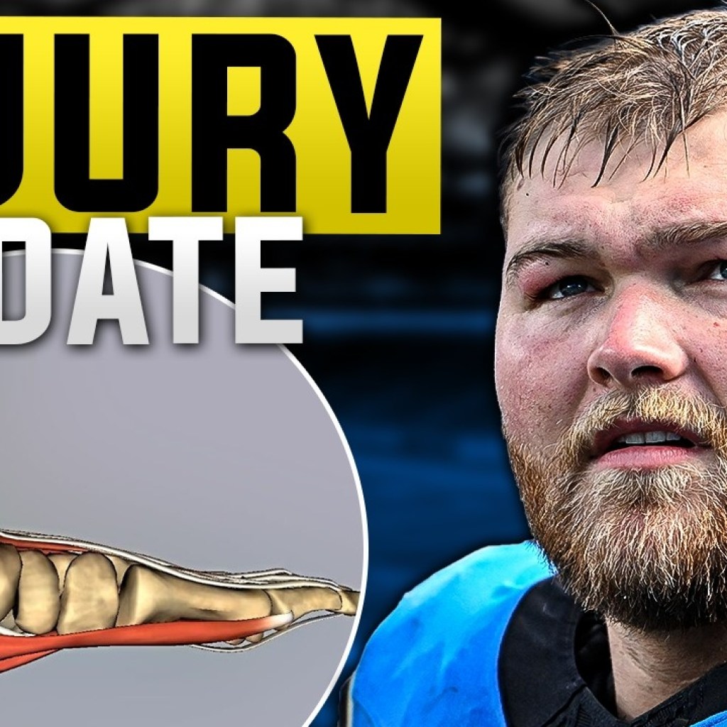 DOCTOR REACTS: Detroit Lions NEW FREE AGENT Injury Update! DOCTOR REACTS: Detroit Lions NEW FREE AGENT Injury Update!
