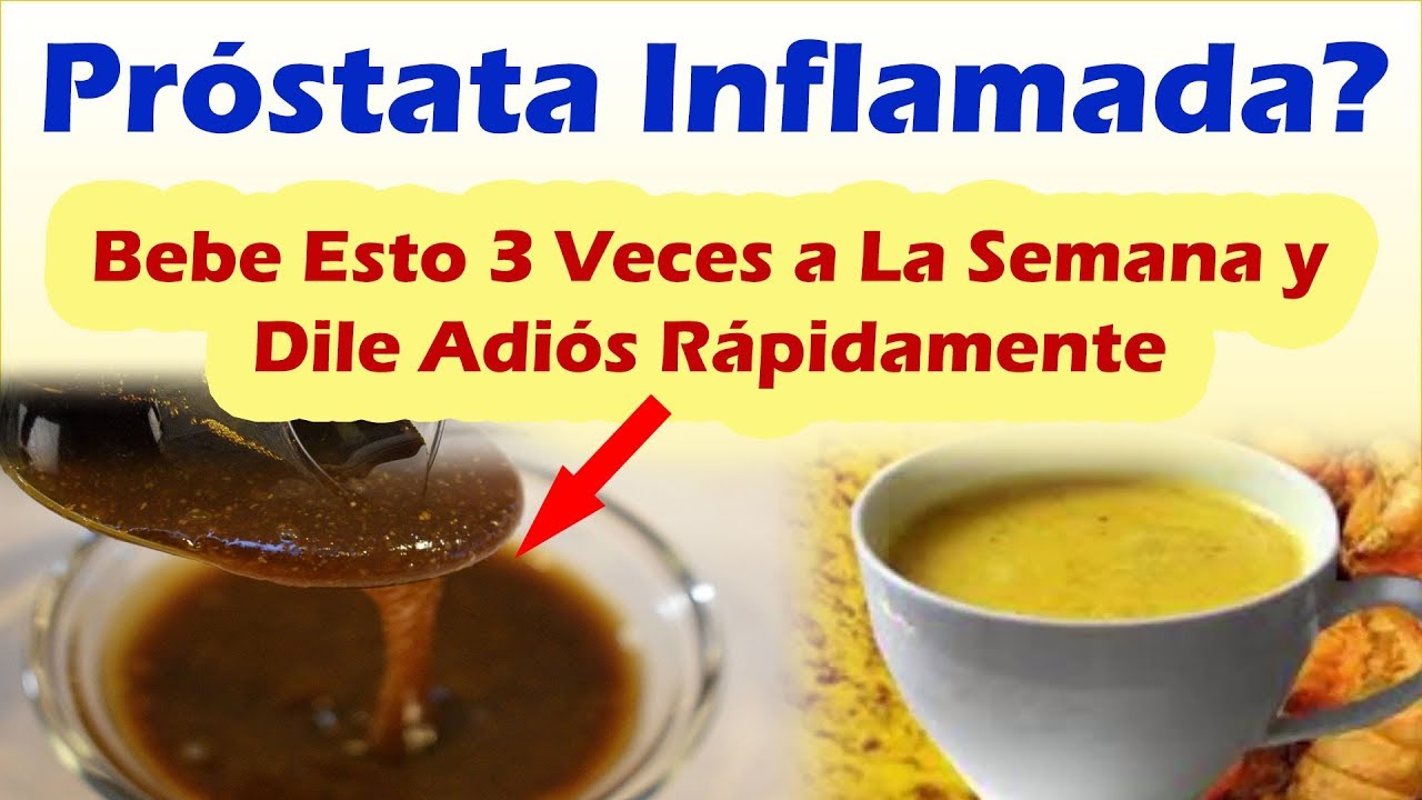 COMO DESINFLAMAR LA PRÓSTATA NATURALMENTE Remedios Caseros Para La Próstata Inflamada COMO DESINFLAMAR LA PRÓSTATA NATURALMENTE Remedios Caseros Para La Próstata Inflamada
