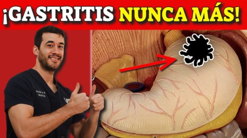 Sígnos y síntomas de alarma de gastritis y cómo se cura (remedios naturales) Sígnos y síntomas de alarma de gastritis y cómo se cura (remedios naturales)