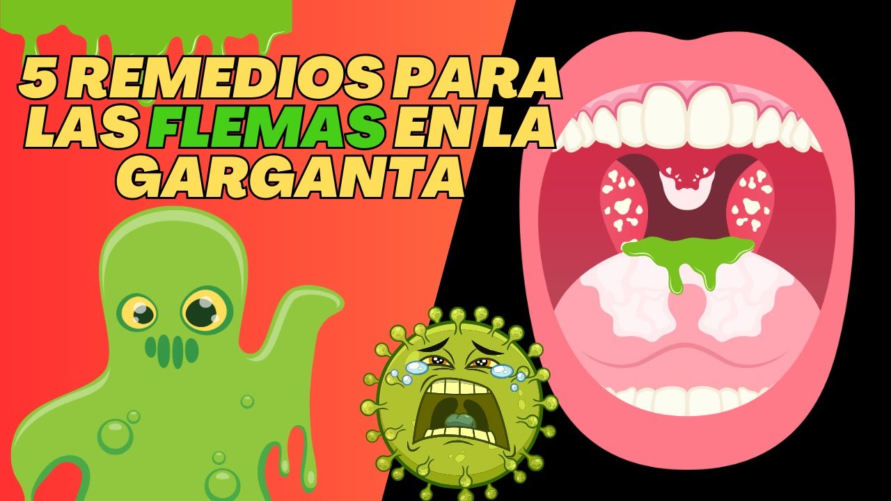 5 REMEDIOS NATURALES PARA LAS FLEMAS! 5 REMEDIOS NATURALES PARA LAS FLEMAS!