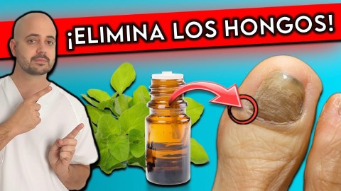 ¡Elimina HONGOS en las UÑAS en 1 DÍA! || 10 REMEDIOS NATURALES para HONGOS en las UÑAS ¡Elimina HONGOS en las UÑAS en 1 DÍA! || 10 REMEDIOS NATURALES para HONGOS en las UÑAS