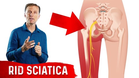5 Herbal Remedies for Sciatica 5 Herbal Remedies for Sciatica