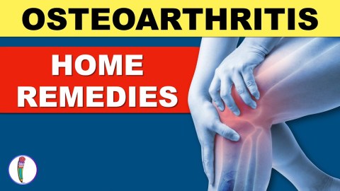 Osteoarthritis treatment | Osteoarthritis Home Remedies | Arthritis Treatment | Joint Pain Treatment Osteoarthritis treatment | Osteoarthritis Home Remedies | Arthritis Treatment | Joint Pain Treatment