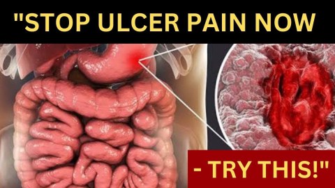 How To Cure Peptic Ulcer Naturally: Foods & Remedies to Try! How To Cure Peptic Ulcer Naturally: Foods & Remedies to Try!