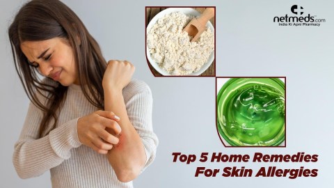 5 Best Natural Remedies For Skin Allergies 5 Best Natural Remedies For Skin Allergies