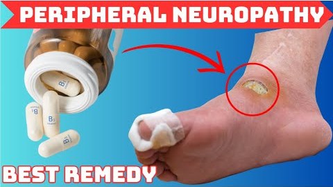 Peripheral NEUROPATHY: Root Cause and Best Remedy Peripheral NEUROPATHY: Root Cause and Best Remedy