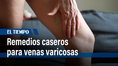 Remedios caseros para venas varicosas: Alivia el dolor y la hinchazón en casa | El Tiempo Remedios caseros para venas varicosas: Alivia el dolor y la hinchazón en casa | El Tiempo