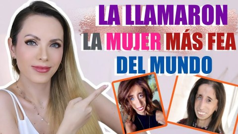 LA LLAMARON LA MUJER MÁS FEA DEL MUNDO, SU HISTORIA ES INSPIRADORA LA LLAMARON LA MUJER MÁS FEA DEL MUNDO, SU HISTORIA ES INSPIRADORA