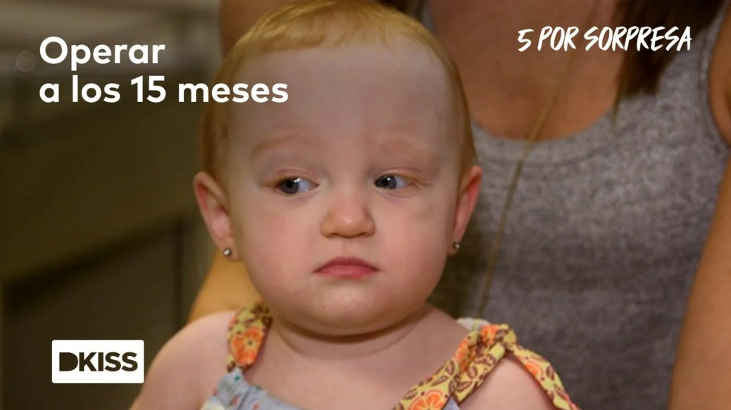 Nistagmo: la enfermedad de la vista de la bebé Hazel Busby Nistagmo: la enfermedad de la vista de la bebé Hazel Busby