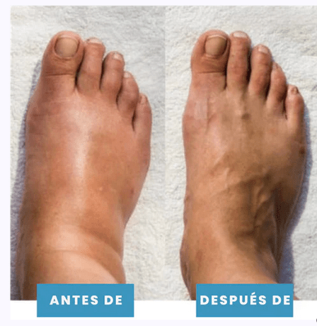 MASAJEADOR DE PIES POSTUR