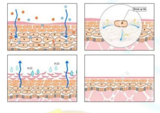 Gel Reductor Chupa Panza Max Quema Grasa