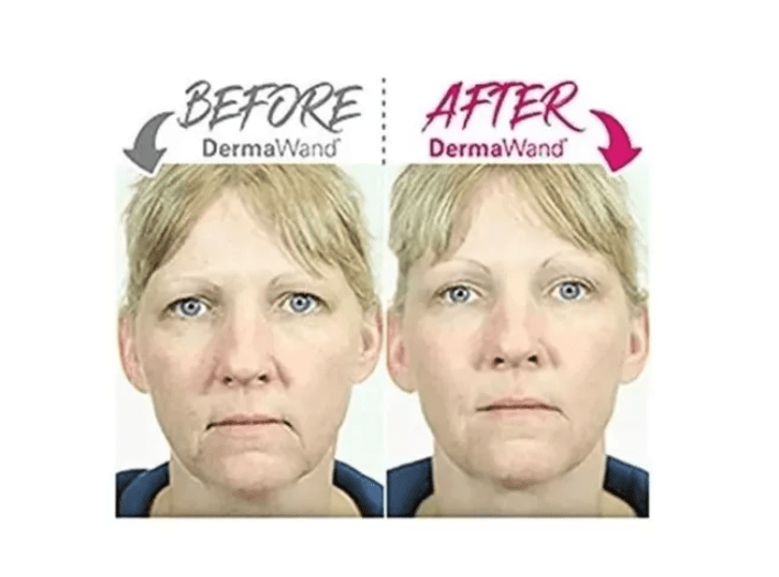 LIFTING Y TONIFICADOR FACIAL