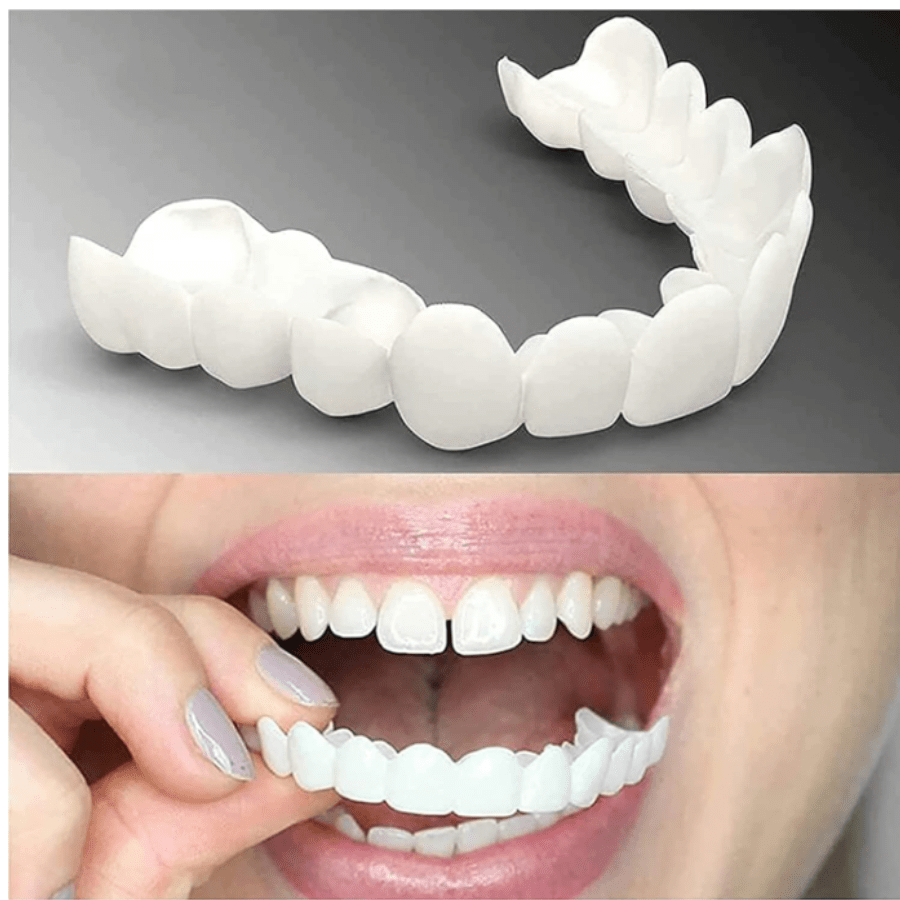 Carillas Dentales Perfecta Sonrisa