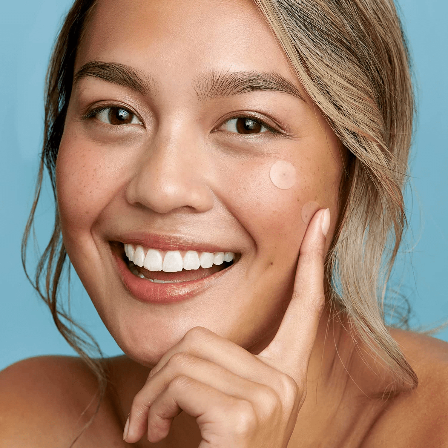 PARCHE PARA ACNE