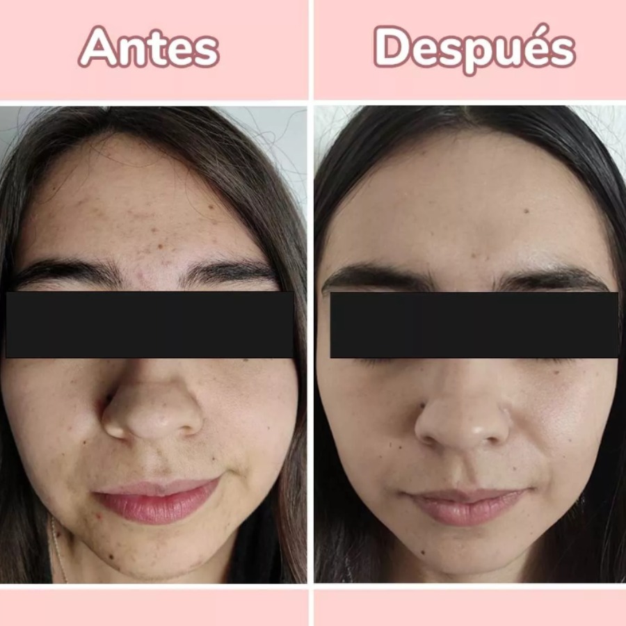 Serum 4 en 1 Antiarrugas y Manchas