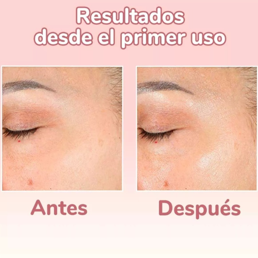 Serum 4 en 1 Antiarrugas y Manchas