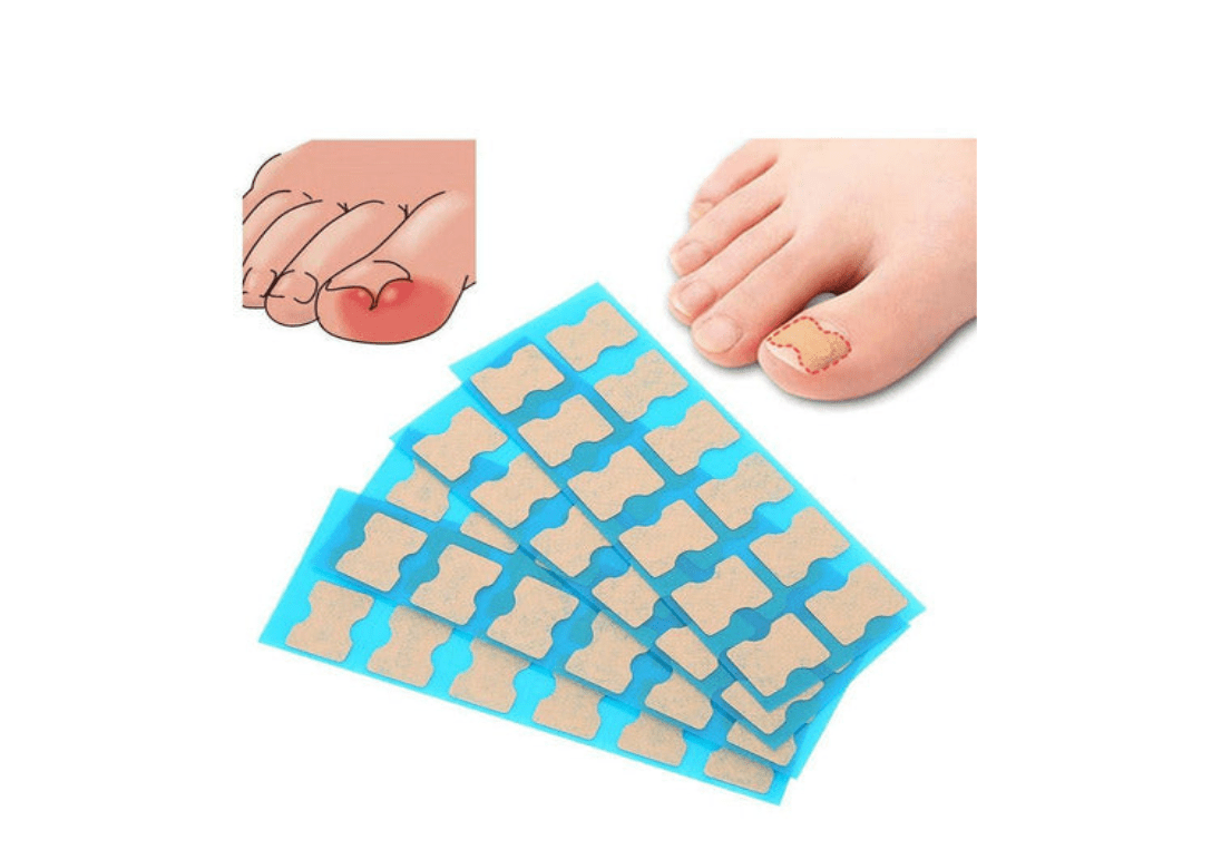 PARCHES UÑAS ENCARNADAS
