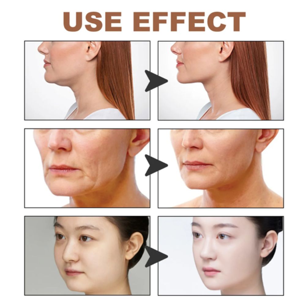 Cinta Tape de Lifting Facial